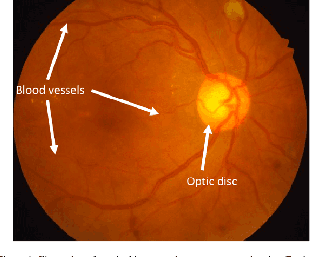 Figure 1 for From Patch to Image Segmentation using Fully Convolutional Networks - Application to Retinal Images