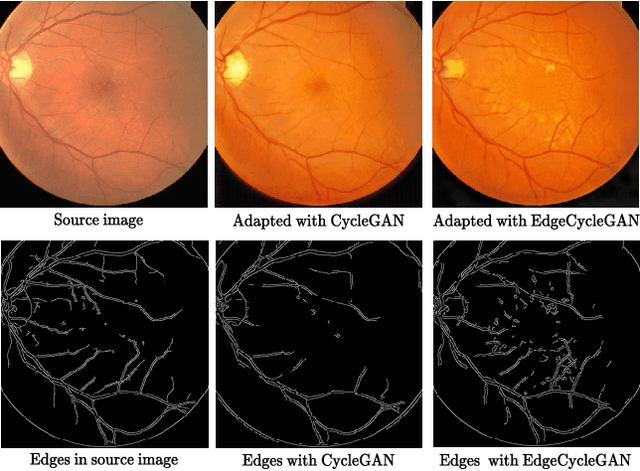 Figure 1 for Edge-preserving Domain Adaptation for semantic segmentation of Medical Images