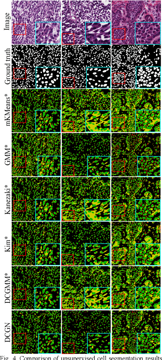 Figure 4 for Unsupervised Tissue Segmentation via Deep Constrained Gaussian Network