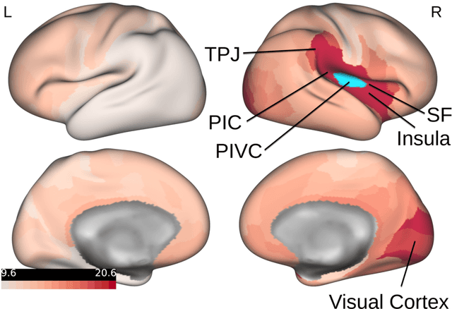 Figure 4 for A Graph Neural Network Framework for Causal Inference in Brain Networks