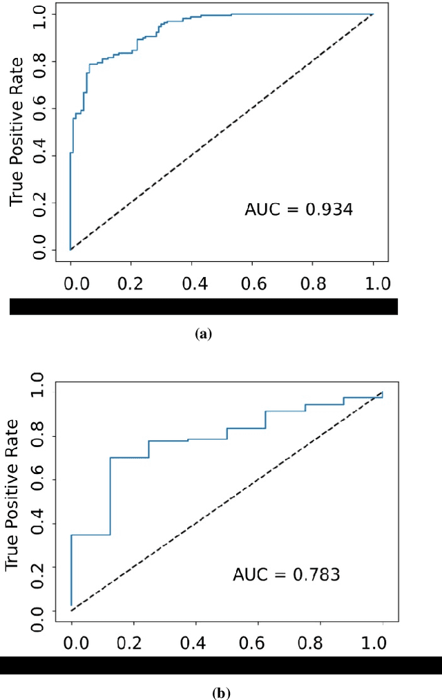 Figure 3 for Comparison of different CNNs for breast tumor classification from ultrasound images