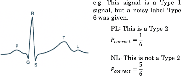 Figure 1 for Negative-ResNet: Noisy Ambulatory Electrocardiogram Signal Classification Scheme