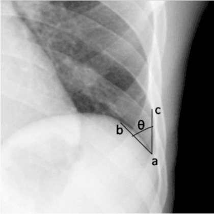Figure 3 for Explaining the Black-box Smoothly- A Counterfactual Approach