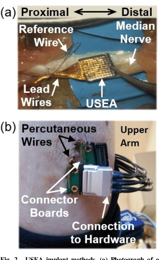 Figure 3 for Discrimination Among Multiple Cutaneous and Proprioceptive Hand Percepts Evoked by Nerve Stimulation with Utah Slanted Electrode Arrays in Human Amputees