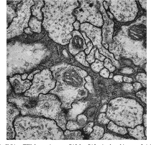 Figure 4 for Efficient Convolutional Neural Networks for Pixelwise Classification on Heterogeneous Hardware Systems