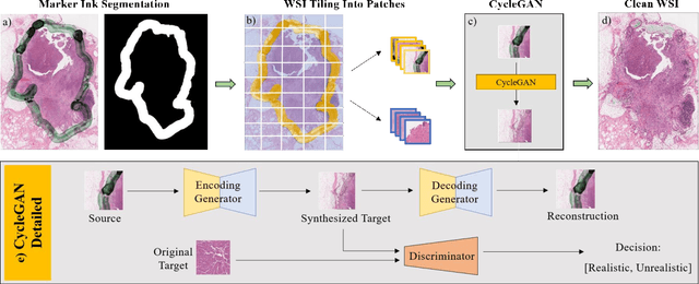 Figure 1 for Restoration of marker occluded hematoxylin and eosin stained whole slide histology images using generative adversarial networks