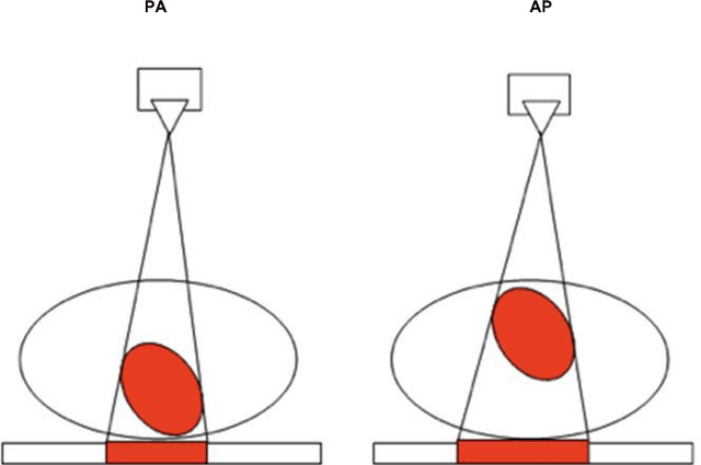 Figure 4 for PadChest: A large chest x-ray image dataset with multi-label annotated reports