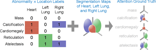 Figure 3 for Explainable multiple abnormality classification of chest CT volumes with AxialNet and HiResCAM