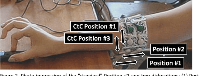 Figure 3 for Effect of the sEMG electrode placement and feature set size on the hand movement recognition