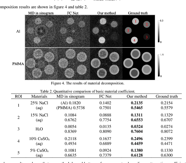 Figure 4 for A novel deep learning-based method for monochromatic image synthesis from spectral CT using photon-counting detectors