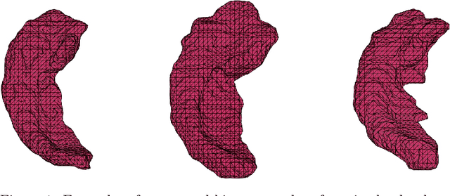 Figure 2 for QC-SPHRAM: Quasi-conformal Spherical Harmonics Based Geometric Distortions on Hippocampal Surfaces for Early Detection of the Alzheimer's Disease