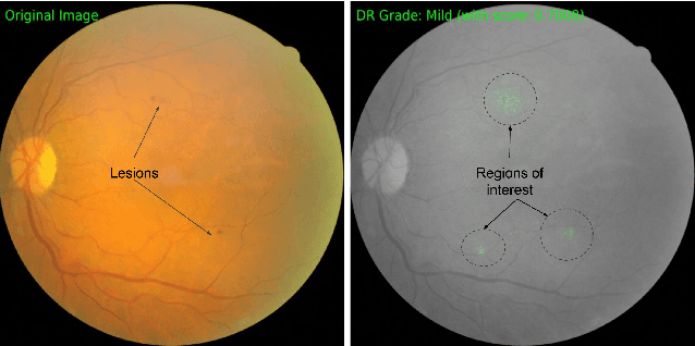 Figure 3 for Axiomatic Attribution for Deep Networks
