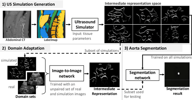 Figure 1 for CACTUSS: Common Anatomical CT-US Space for US examinations