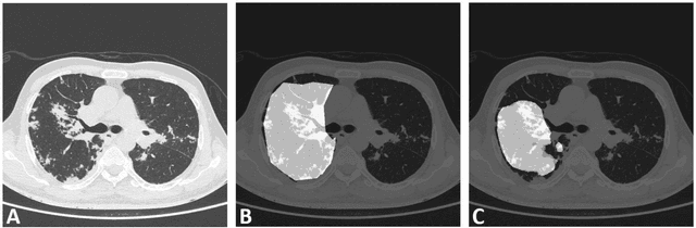 Figure 3 for Role of Edge Device and Cloud Machine Learning in Point-of-Care Solutions Using Imaging Diagnostics for Population Screening