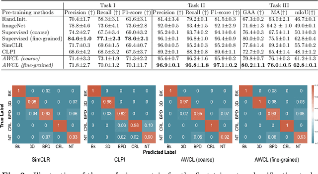 Figure 4 for Anatomy-Aware Contrastive Representation Learning for Fetal Ultrasound
