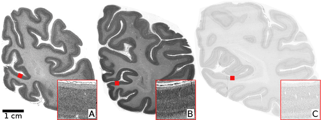 Figure 3 for Convolutional Neural Networks for cytoarchitectonic brain mapping at large scale