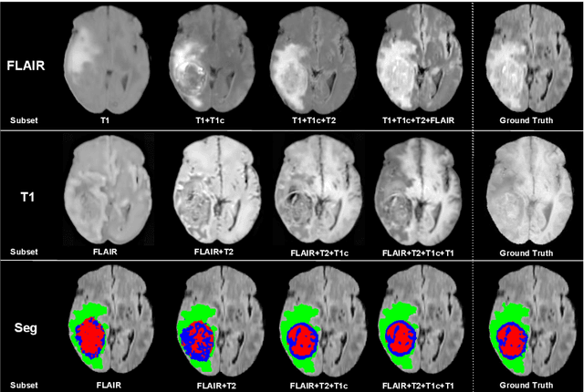 Figure 4 for Hetero-Modal Variational Encoder-Decoder for Joint Modality Completion and Segmentation