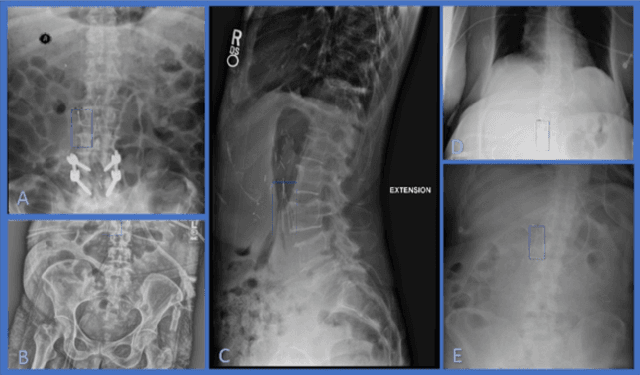 Figure 2 for Developing and Deploying Machine Learning Pipelines against Real-Time Image Streams from the PACS