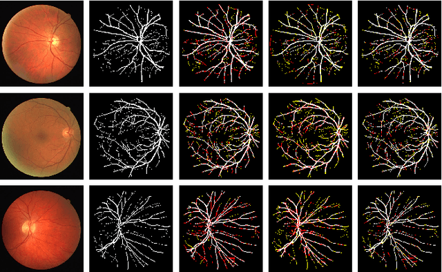 Figure 4 for MKIS-Net: A Light-Weight Multi-Kernel Network for Medical Image Segmentation