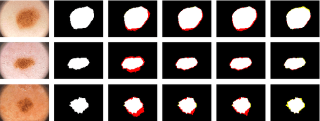 Figure 2 for MKIS-Net: A Light-Weight Multi-Kernel Network for Medical Image Segmentation