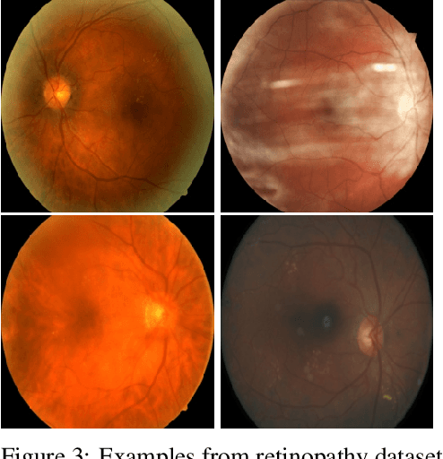 Figure 3 for Radial Bayesian Neural Networks: Robust Variational Inference In Big Models