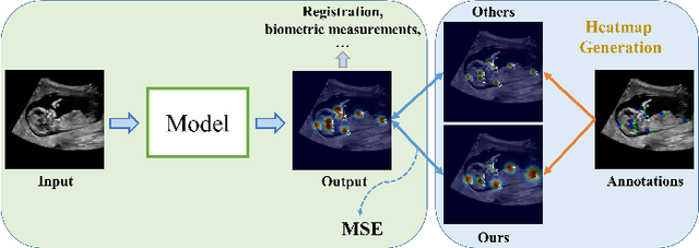 Figure 1 for Learn Fine-grained Adaptive Loss for Multiple Anatomical Landmark Detection in Medical Images