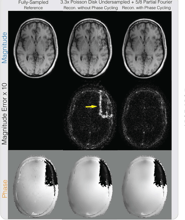 Figure 4 for General Phase Regularized Reconstruction using Phase Cycling