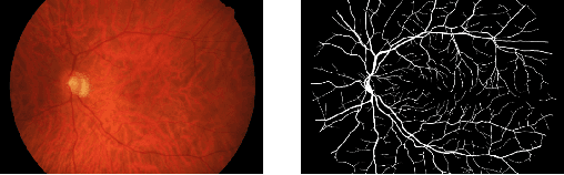 Figure 3 for CvS: Classification via Segmentation For Small Datasets
