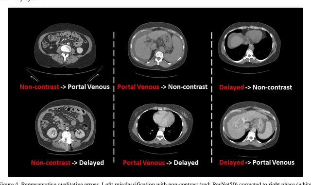 Figure 4 for Contrast Phase Classification with a Generative Adversarial Network