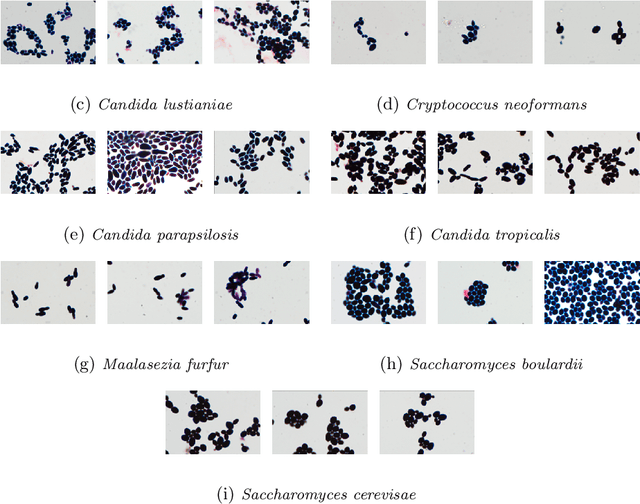Figure 3 for Deep learning approach to description and classification of fungi microscopic images