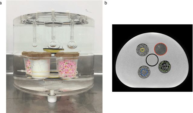 Figure 3 for A multicenter study on radiomic features from T$_2$-weighted images of a customized MR pelvic phantom setting the basis for robust radiomic models in clinics