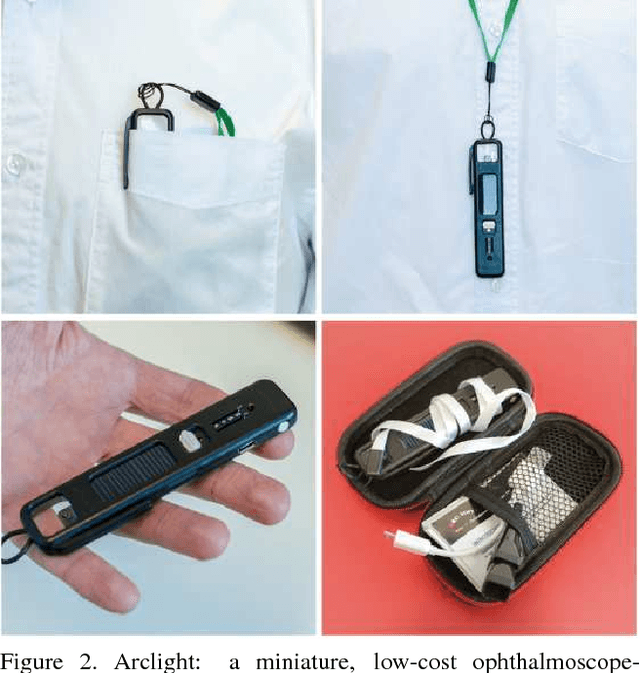 Figure 2 for Synthesising Wider Field Images from Narrow-Field Retinal Video Acquired Using a Low-Cost Direct Ophthalmoscope (Arclight) Attached to a Smartphone