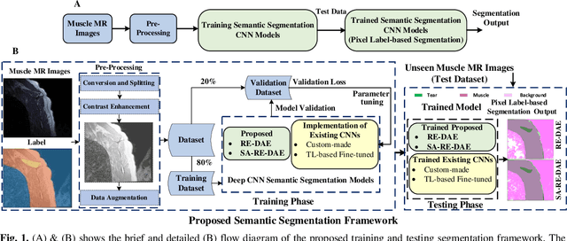 Figure 1 for Segmentation of Shoulder Muscle MRI Using a New Region and Edge based Deep Auto-Encoder