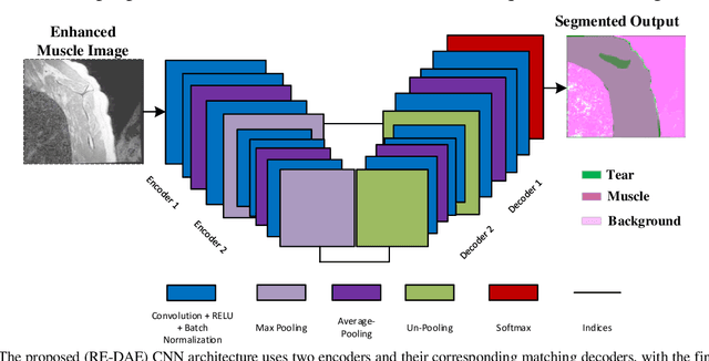 Figure 3 for Segmentation of Shoulder Muscle MRI Using a New Region and Edge based Deep Auto-Encoder