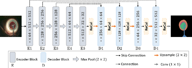 Figure 1 for ReCal-Net: Joint Region-Channel-Wise Calibrated Network for Semantic Segmentation in Cataract Surgery Videos