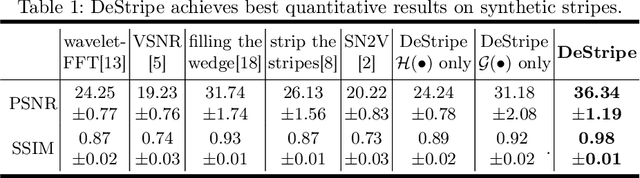 Figure 2 for DeStripe: A Self2Self Spatio-Spectral Graph Neural Network with Unfolded Hessian for Stripe Artifact Removal in Light-sheet Microscopy