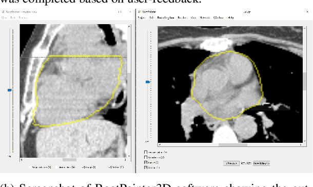 Figure 3 for RootPainter3D: Interactive-machine-learning enables rapid and accurate contouring for radiotherapy