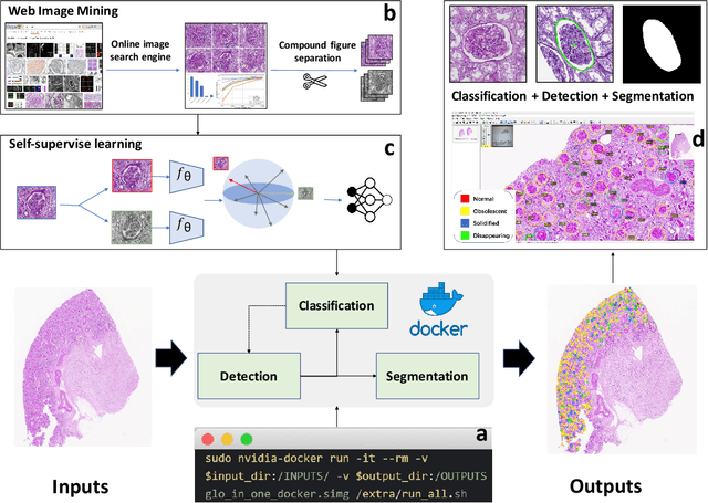 Figure 1 for Glo-In-One: Holistic Glomerular Detection, Segmentation, and Lesion Characterization with Large-scale Web Image Mining