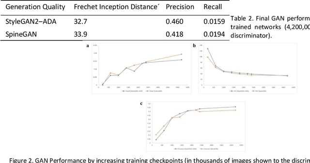 Figure 3 for Generative Adversarial Network Based Synthetic Learning and a Novel Domain Relevant Loss Term for Spine Radiographs