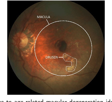Figure 1 for Which Generative Adversarial Network Yields High-Quality Synthetic Medical Images: Investigation Using AMD Image Datasets
