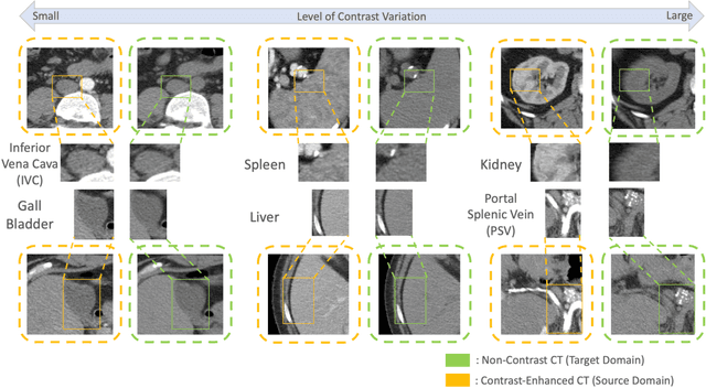 Figure 1 for Pseudo-Label Guided Multi-Contrast Generalization for Non-Contrast Organ-Aware Segmentation