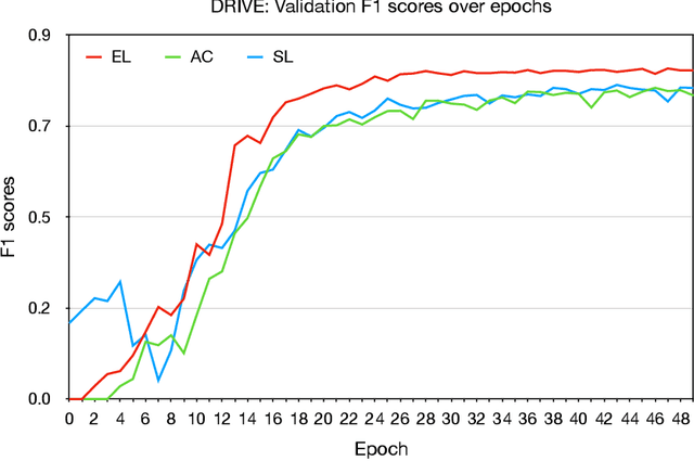 Figure 3 for An Elastic Interaction-Based Loss Function for Medical Image Segmentation
