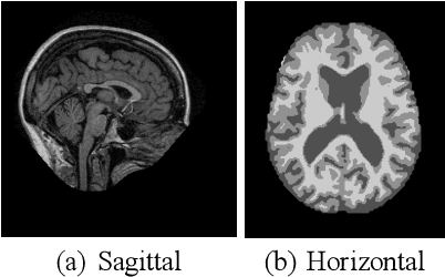 Figure 1 for Automatic Assessment of Alzheimer's Disease Diagnosis Based on Deep Learning Techniques