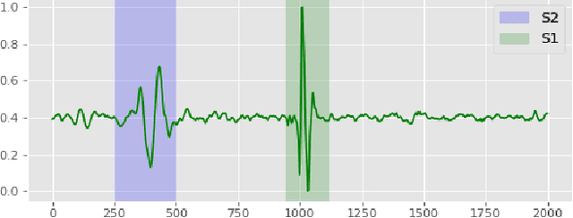 Figure 1 for Understanding the Importance of Heart Sound Segmentation for Heart Anomaly Detection