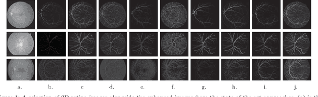 Figure 1 for Curvilinear Structure Enhancement by Multiscale Top-Hat Tensor in 2D/3D Images