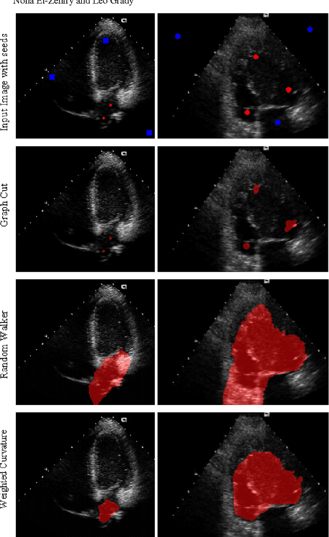 Figure 4 for Optimization of Weighted Curvature for Image Segmentation