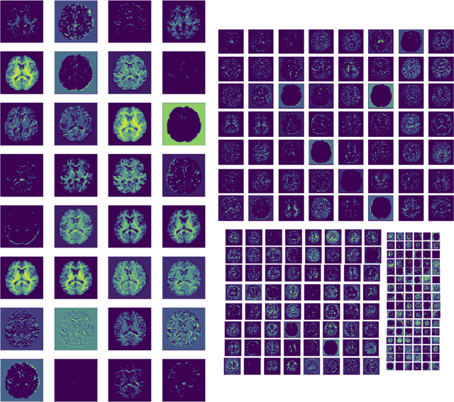 Figure 2 for Challenges for machine learning in clinical translation of big data imaging studies