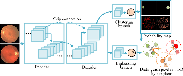 Figure 3 for Unsupervised Learning of Local Discriminative Representation for Medical Images
