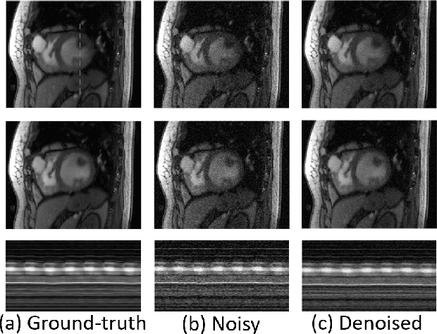 Figure 4 for Recovery of Noisy Points on Band-limited Surfaces: Kernel Methods Re-explained