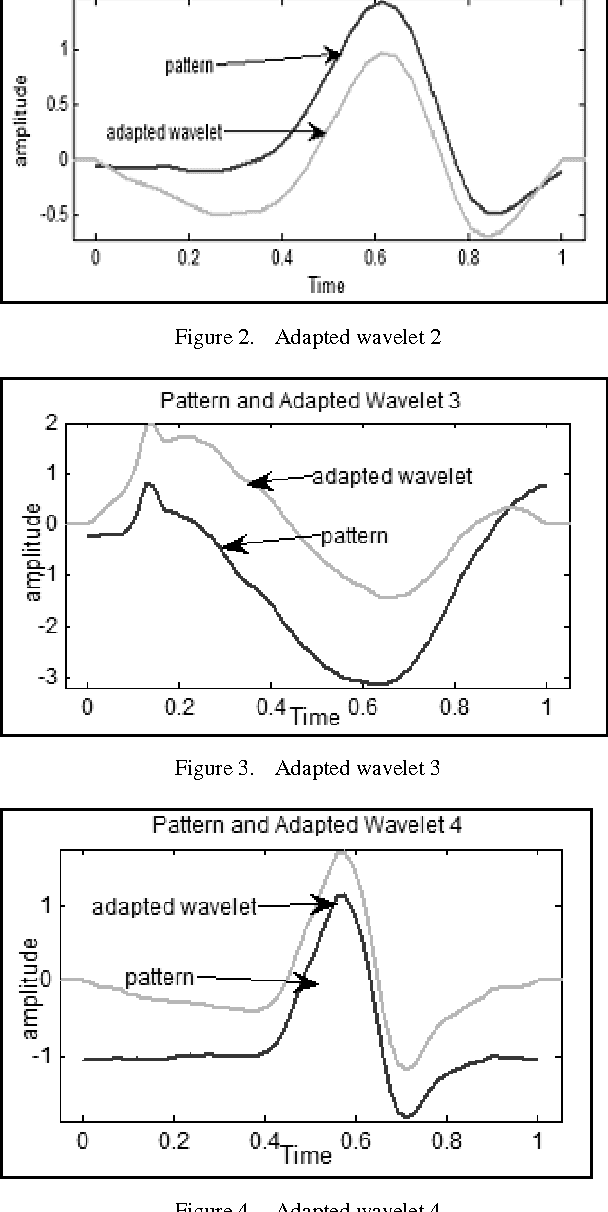 Figure 3 for Methodology For Detection of QRS Pattern Using Secondary Wavelets